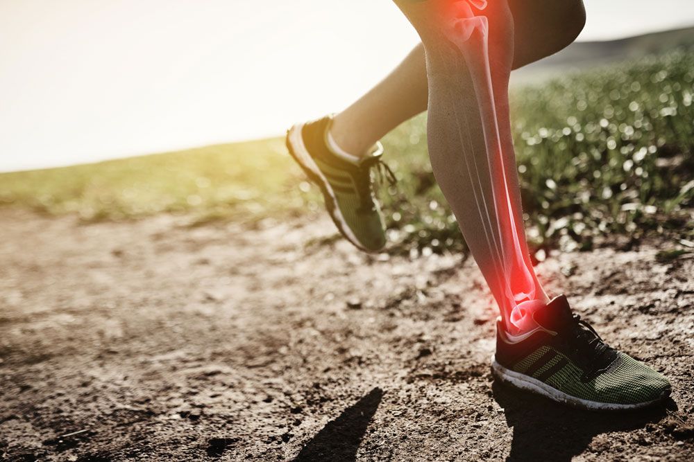 Runner with pain visible in leg